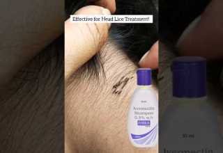 Lice Nits Removal Home Remedy Liceremoval Licecomb Licetreatment Haircare Liceremoval Piojos