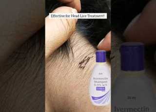 Lice Nits Removal Home Remedy Liceremoval Licecomb Licetreatment Haircare Liceremoval Piojos