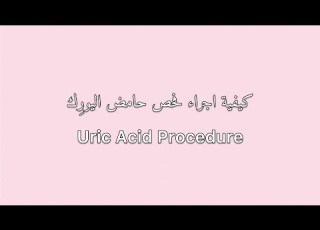 كيفية اجراء فحص حامض اليوريك Uric Acid Procedure Uricase Method