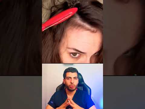 الصدفية ب الرأس صدفية صدفية الجسم كريمات كريم علاج Psoriasis د مصعب حسوا ثقف نفسك طبيا الصدفية ب الرأس صدفية صدفية الجسم كريمات كريم علاج Psoriasis د مصعب حسوا ثقف نفسك طبيا
