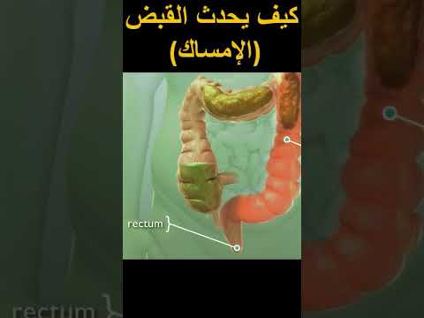 كيف يحدث القبض أو الإمساك امساك قبض صحة صحة وتغذية بطن علاج طب مرض معدة Constipation