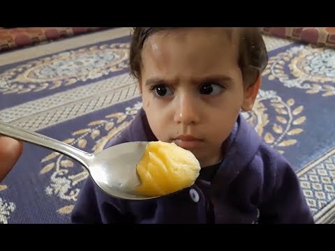 طريقة خرافية لعلاج الكدمات المفاجئة للاطفال فديو عملي طريقة خرافية لعلاج الكدمات المفاجئة للاطفال فديو عملي