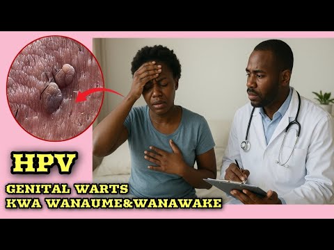 UGONJWA WA GENITAL WARTS CHANZO NA TIBA