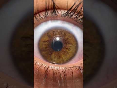 سبحان الله الذي احسن كل شيئ خلقة Yemen تصوير عيون سبحان الله الذي احسن كل شيئ خلقة Yemen تصوير عيون