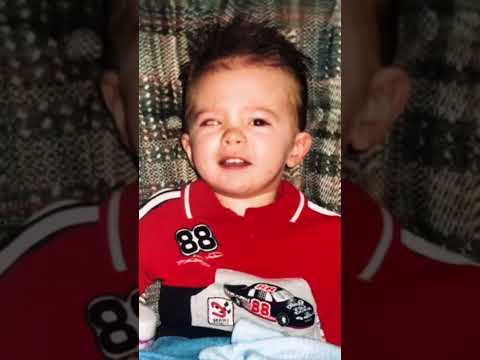 WHEN I LOST MY EYEBALL