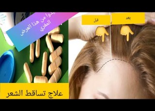 Forcapil Gellules Lotion برنامج شامل لعلاج تساقط الشعر بثمن اقتصادي