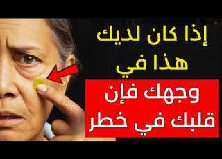 A Cardiologist S Warning If You Have These 7 Signs Do Not Ignore Them