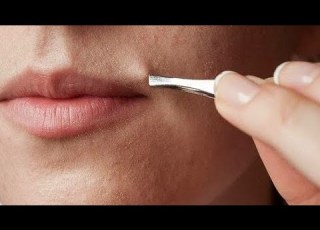  ازاله شعر الجسم والوجه نهائياومنع نموه مجددا مجربه سلسله العروس