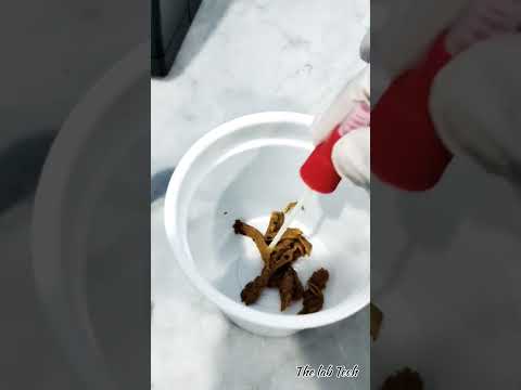 Faecal Occult Blood Test Stool Poop Bloodtest Ob Thelabtech