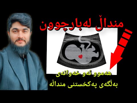 منداڵ لەبارچوون وەڵامی خەو