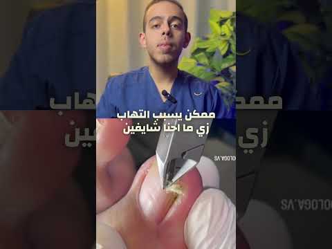 Solving The Problem Of Ingrown Toenails Causes And Appropriate Treatments In A Simplified Manner