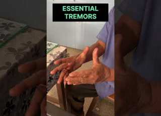 Essential Tremors Action Tremors Viralvideo Neurology Trending Tremor