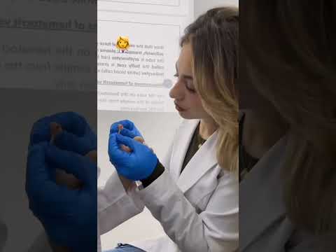 يلا يا دكتور بيا الوجع ستوري لانا محمد جيش لنوش اكسبلور الشامي دكتور