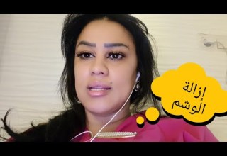 تعرف بسيط عن ليزر إزالة الوشم ليزر إزالة الشعر
