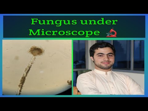 Fungus Under Microscope E Learn With Technologist