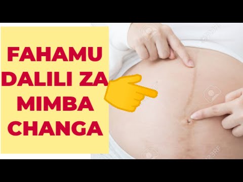 UKIONA DALILI HIZI Hongera Dalili Za Mimba Changa