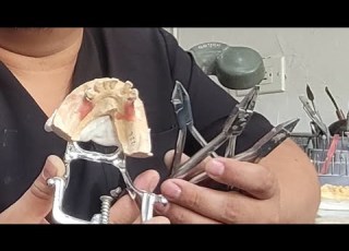  How To Make Whipple Clasps For Dental Prosthetics