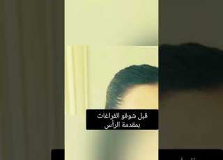  شو بنبسط بنتائج الصبايا الي ملتزمين بنصائح العناية ابلور تجميل Haircare Hair Shorts