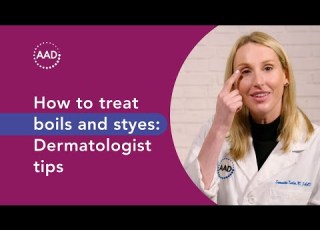 How To Treat Boils Styes Dermatologist Tips