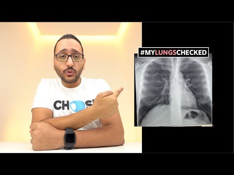 VAPE WAR حرب الفيب