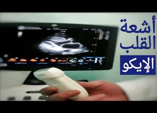 أشعة الموجات فوق الصوتية على القلب الإيكو