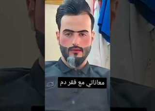 معاناتي مع فقر الدم الفيديو الاصلي عبود ابو شيبه Shorts