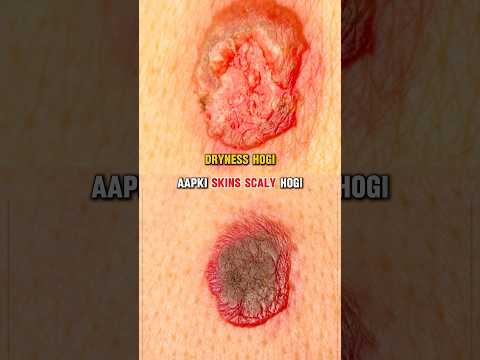 How Should You Care For An Injury Should You Dress A Wound Or Not