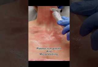 Tips For A Gorgeous Neck And Décolleté Neckrejuvenation Tips For A Gorgeous Neck And Décolleté Neckrejuvenation