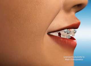 Extractions 4
