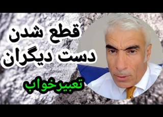 تعبیر خواب قطع شدن دست دیگران کنده شدن دست دیگران در خواب تعبیرخواب