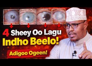  4 Sheey Oo Lagu Indho Beelo Adigoon Ogaan Sheekh Xasaan
