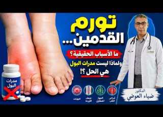  الدكتور ضياء العوضي تورم القدمين ما الأسباب الحقيقية ولماذا ليست مدرات البول هي الحل