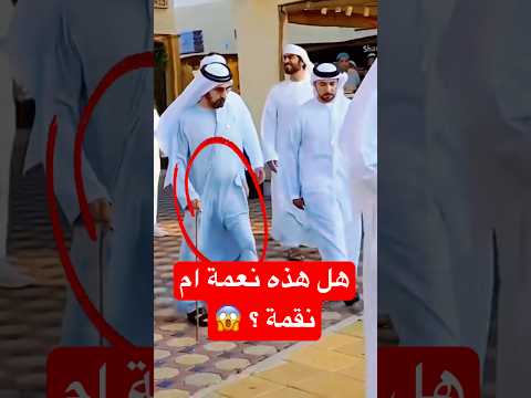 هذه نعمة ام مرض الشيخ راشد آل مكتوم أخبار اكسبلور Fashion مشاهير Bestvedios Trending