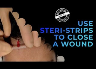 How To Apply Steri Strips To A Laceration Wound Closure Butterfly