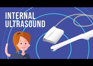 Having A Transvaginal Ultrasound With Queensland X Ray