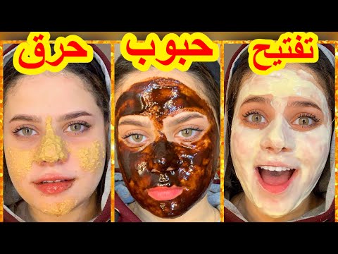 ماسكات من المطبخ جابت نتيجة للتفتيح وازالة الحبوب جربت ماسك جديدحرق وشى تفتيح الاماكن الحساسه