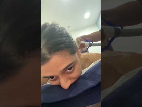 LASER HAIR REMOVAL PROCESS Ashortaday Shorts LASER HAIR REMOVAL PROCESS Ashortaday Shorts