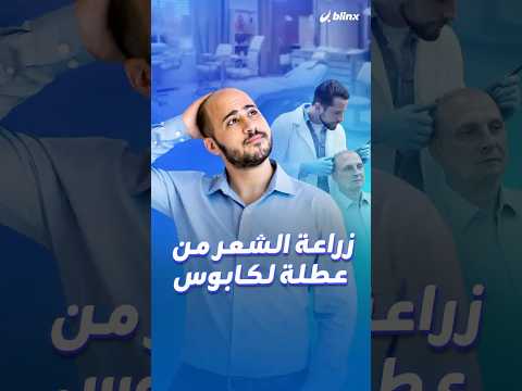 نصف مليون مقيم سافروا من بريطانيا للخارج لزرع الشعر فعاد كثيرون بمشكلات صحية ونفسية ولم ينبت لهم شعر