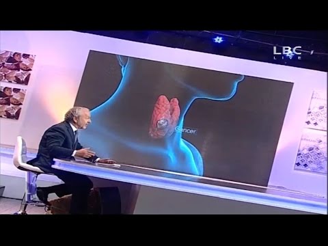 سرطان الغدة الدرقية أسباب وعلاجات