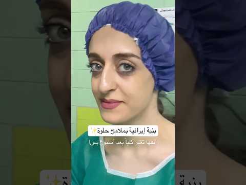 قبل وبعد عملية تجميل الأنف لبنية إيرانية حلوة فرق كبيـر من أول أسبوع بس