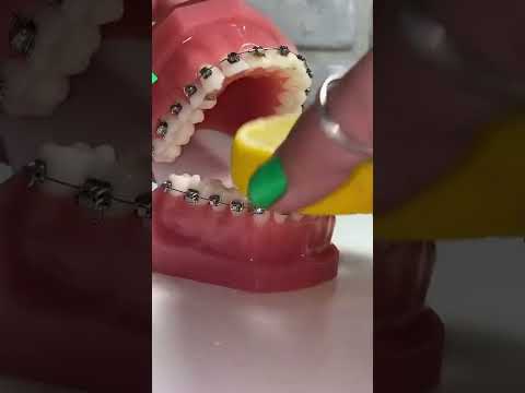 شكل الي مركب تقويم كيف ياكل صح ام خطأ