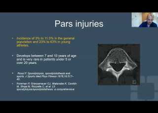  Full Webinar Management And Rehabilitation Of Low Back Pars Stress Fracture