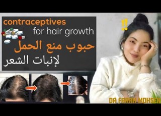 استخدام أقراص منع الحمل والهرمونات الأنثوية موضعيا لإنبات الشعر TOPICAL CONTRACEPTIVES FOR GROWTH
