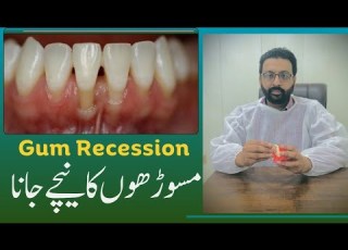  What Is Gum Recession Can Gums Grow Back Ateeqdentalcare