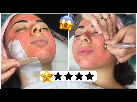 رحت لارخص صالون للعناية بالبشرة في مدينتي ما توقعت النتيجة