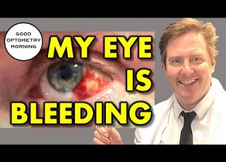  HOW TO TREAT BROKEN BLOOD VESSEL IN EYE What Does It Mean How To Treat Bleeding Or Bloodshot Eye