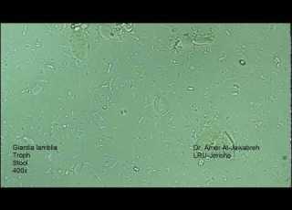 Giardia Lamblia Intestinalis Trophozoite