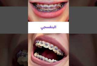 افضل الوان التقويم للبنات عيادة اسنان عيادات أسنان اللؤلؤ