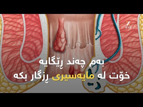 بەم چەند ڕێگایە خۆت لە مایەسیری ڕزگار بکە