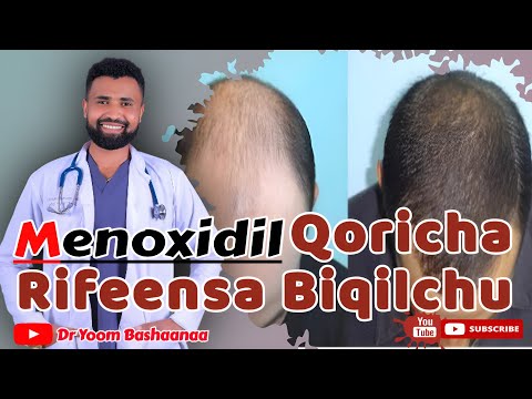 Waa Ee MINOXIDIL Qoricha Rifeensa Biqilchu Wanta Beekamuu Qabu